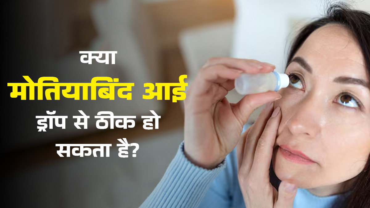क्या मोतियाबिंद को आई ड्रॉप से ठीक किया जा सकता है? जानें डॉक्टर से सच्चाई