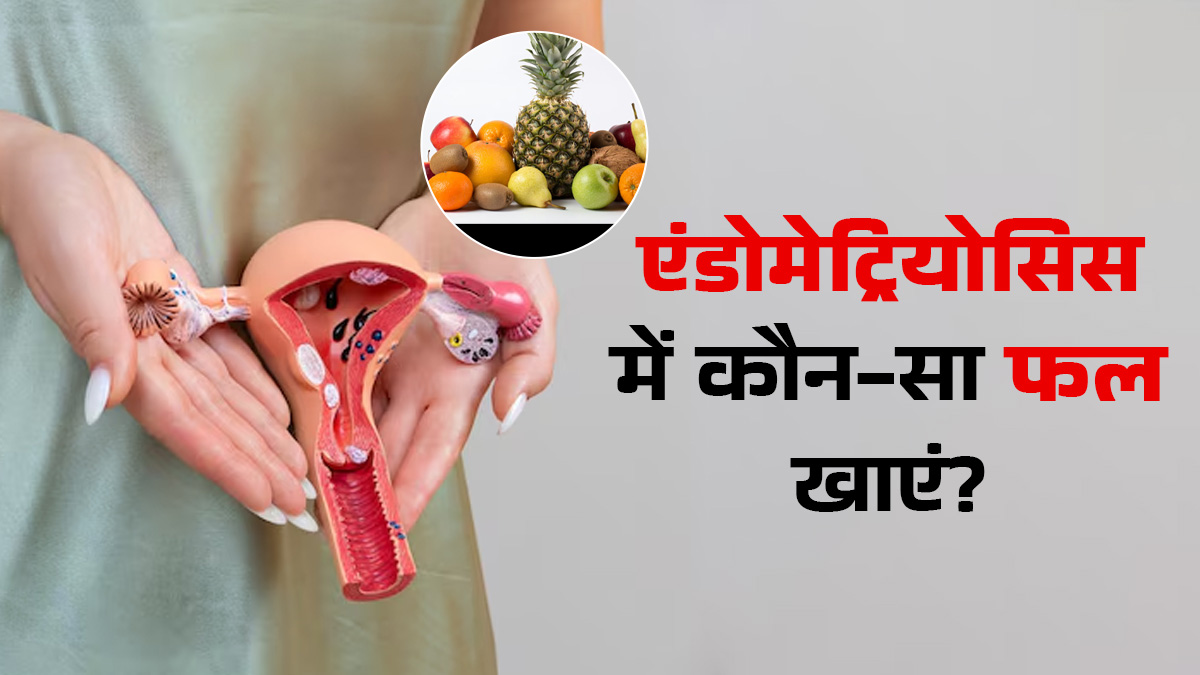 एंडोमेट्रियोसिस के लिए सबसे अच्छा फल कौन सा है? जानें डॉक्टर से