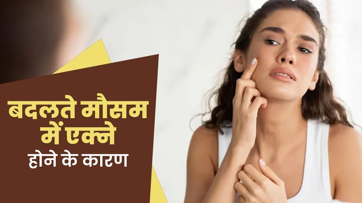 मौसम में बदलाव के साथ चेहरे पर निकलने लगते हैं एक्ने? डॉक्टर से जानें इसके कारण