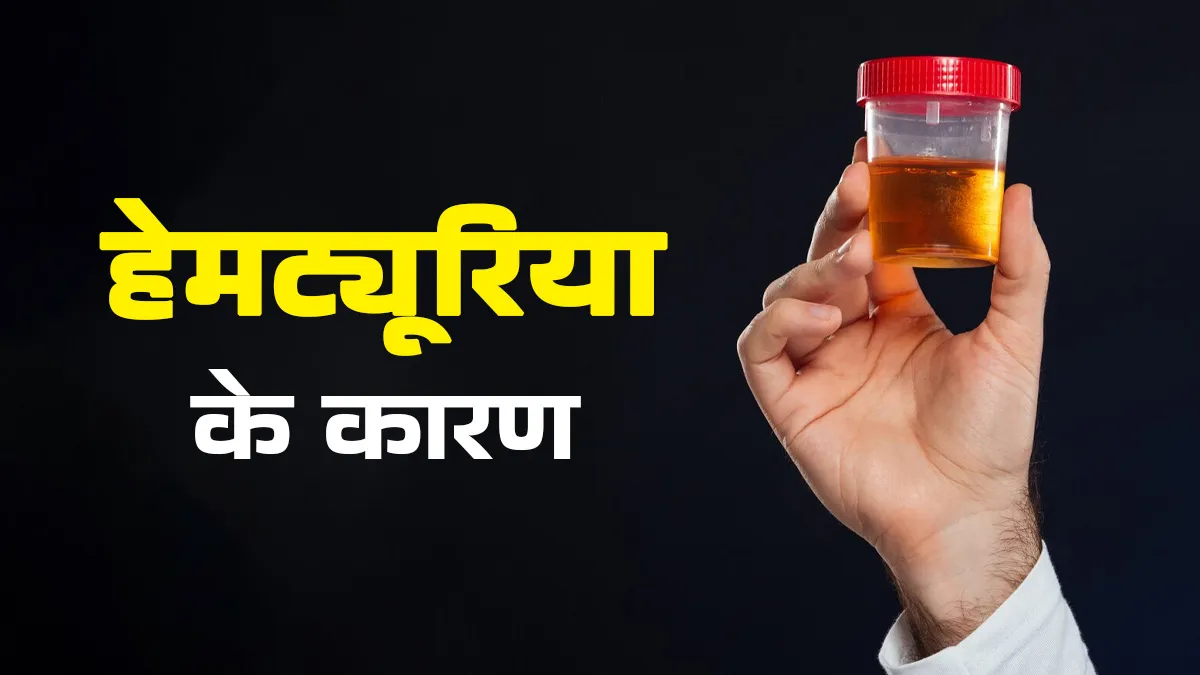हेमट्यूरिया का क्या कारण है? डॉक्टर से जानें