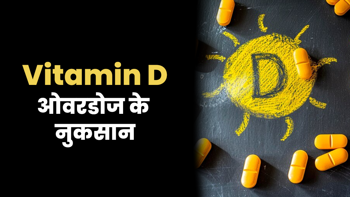 Vitamin D के ओवरडोज से हो सकते हैं 5 नुकसान? जानें न्यूट्रिशनिस्ट से