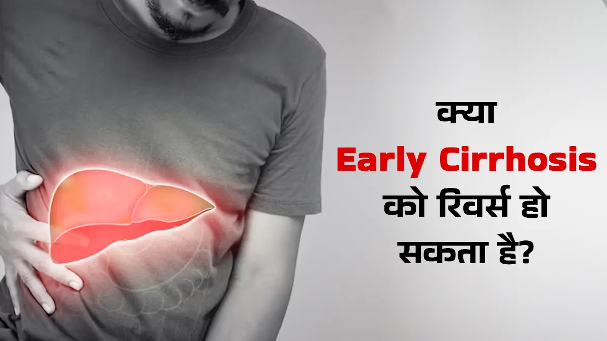 क्या शुरुआती स्टेज के लिवर सिरोसिस को पूरी तरह ठीक किया जा सकता है? डॉक्टर से जानें

