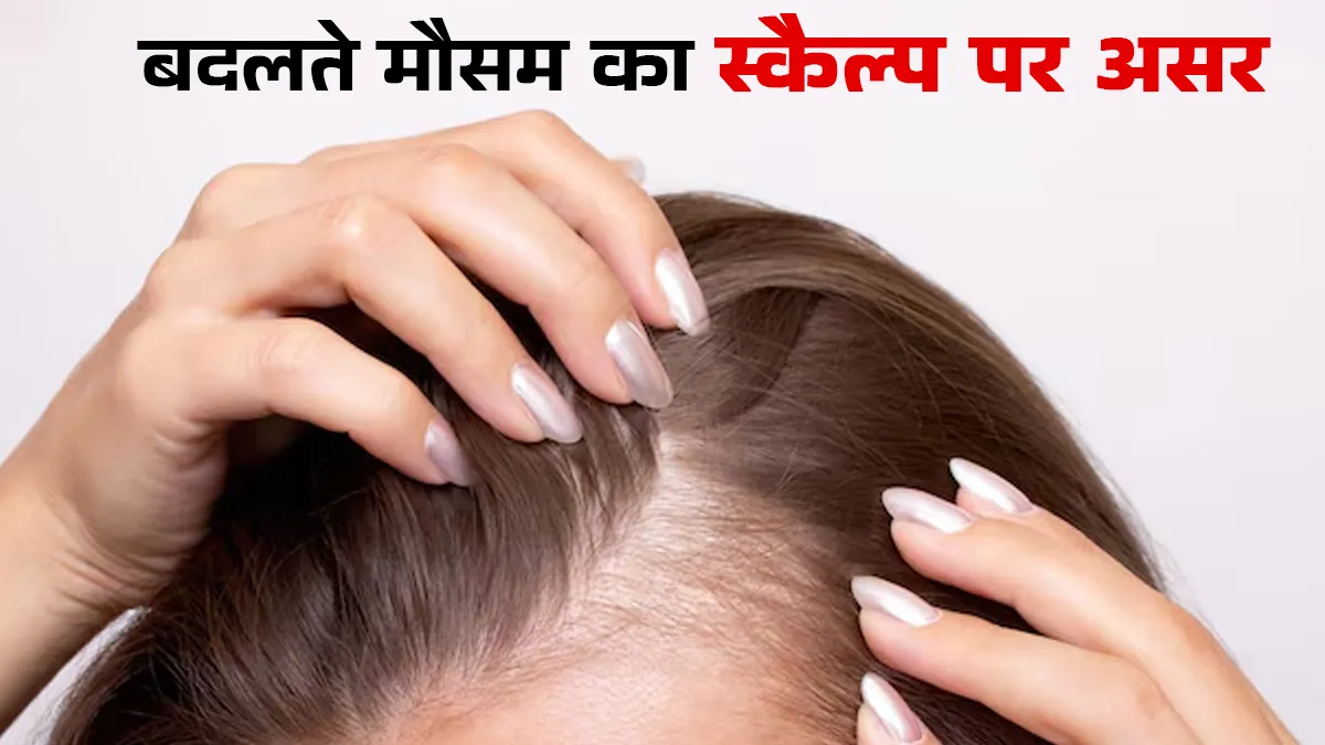 बदलते मौसम में आपके स्कैल्प पर पड़ सकता है बुरा असर? डॉक्टर से जानें कैसे
