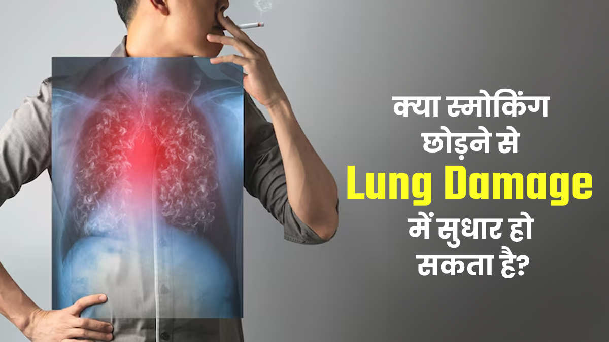 क्या स्मोकिंग छोड़ने से फेफड़ों का डैमेज पूरी तर  ठीक हो सकता है? जानें डॉक्टर से