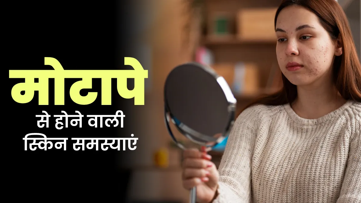 मोटापे से कौन सी स्किन समस्याएं होती है? डॉक्टर से जानें कारण