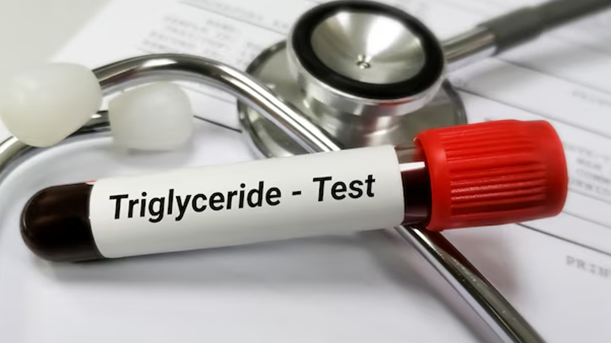 high triglycerides