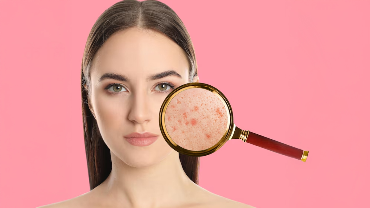 dry skin due to iron deficiency