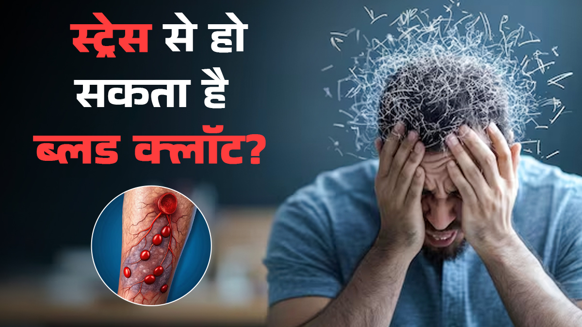 क्या खून के थक्‍के (Blood Clots) बनने का कारण हो सकता है स्‍ट्रेस? डॉक्‍टर से जानें