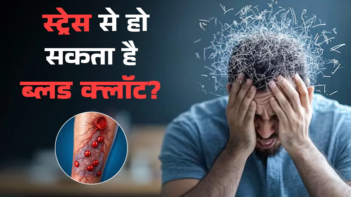 क्या खून के थक्के (Blood Clots) बनने का कारण हो सकता है स्ट्रेस? डॉक्टर से जानें