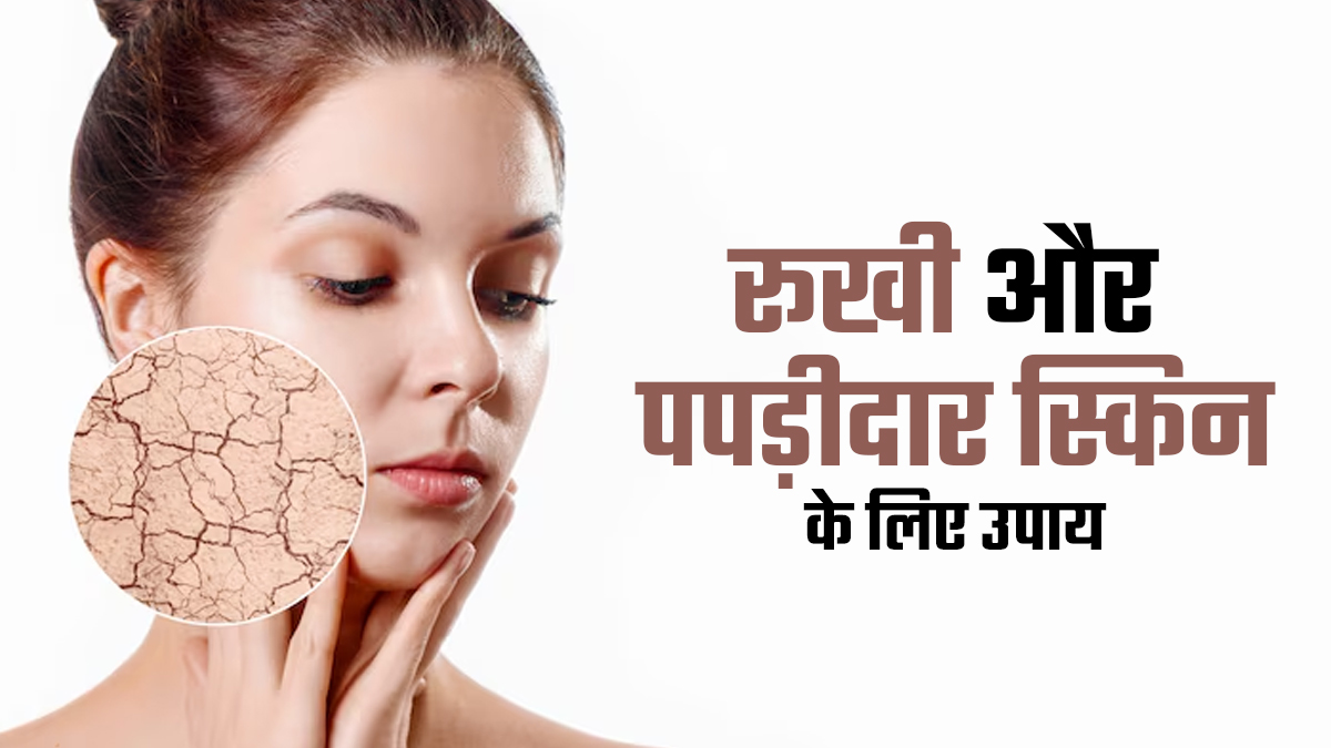 रूखी और पपड़ीदार स्किन के लिए कारगर हैं ये घरेलू उपचार, जानें कौन से इंग्रेडिएंट्स देंगे नेचुरल मॉइश्चर