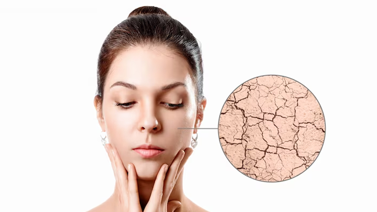 How to manage dry or flaky skin