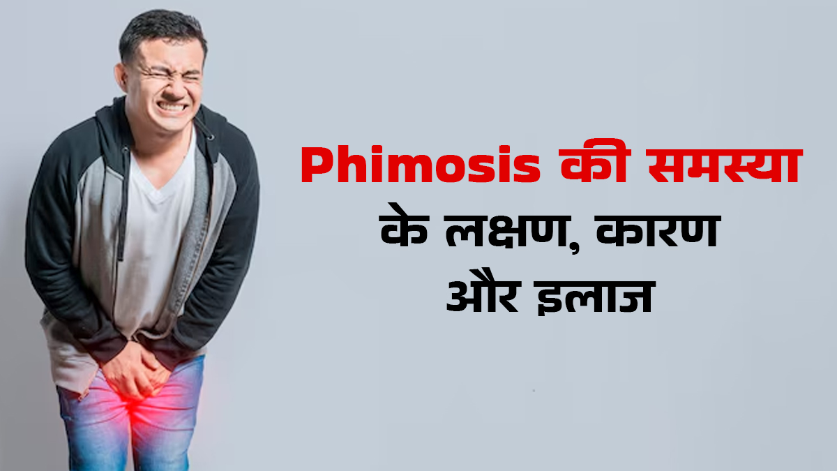 इन कारणों से पुरुषों को होती है phimosis की समस्या, डॉक्टर से जानें इसके लक्षण और इलाज