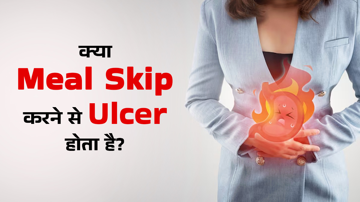क्या मील स्किप करने से हो सकता है अल्सर, जानें क्या कहते हैं डॉक्टर