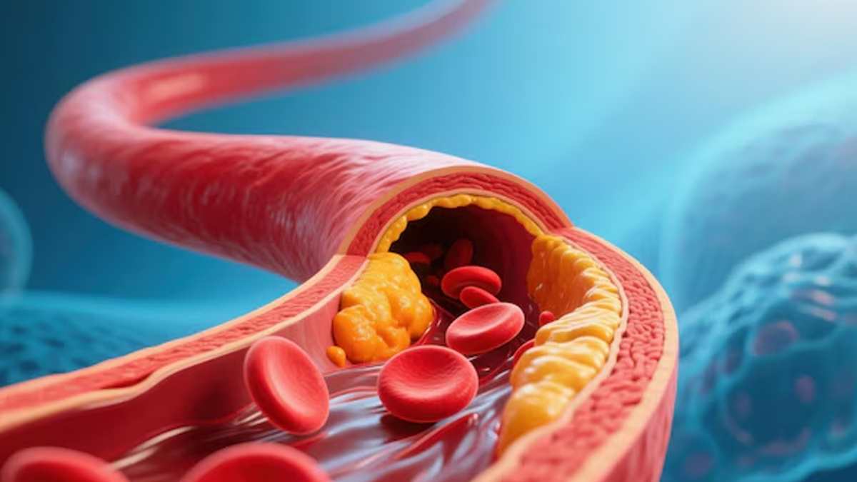 leaves to help lower cholesterol levels naturally in hindi 01 (5)