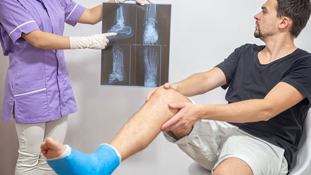 frequent-fracture-causes