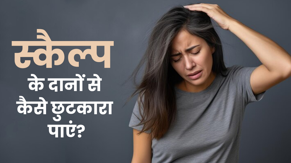 बार-बार खुजली करने से स्कैल्प में हो गए हैं लाल दाने, जानें छुटकारा पाने के टिप्स