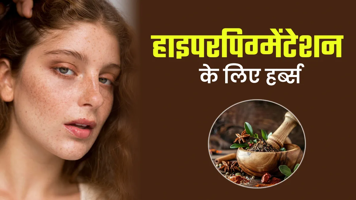 हाइपरपिग्मेंटेशन की समस्या दूर करने के लिए खाएं ये 5 जड़ी-बूटियां, मिलेगे कई फायदे