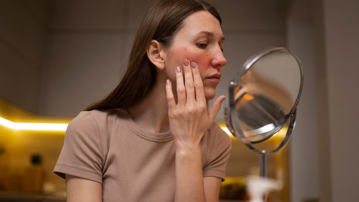 face breakouts cause