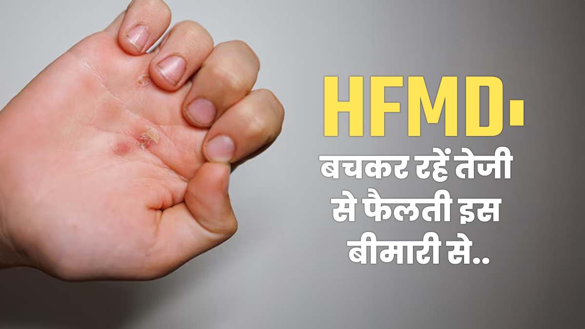 Hand foot Mouth Disease: मुंह में दर्दनाक छाले के साथ दिखते हैं ये लक्षण, जानें अमेरिका में तेजी से बढ़ते इस रोग के बारे में