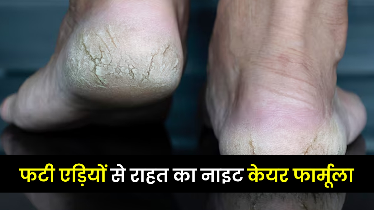 सूखी-फटी एड़ियों से परेशान हैं? अपनाएं ये नाइट स्‍क‍िन रूटीन फार्मूला और पाएं राहत