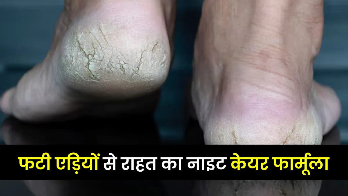 सूखी-फटी एड़ियों से परेशान हैं? अपनाएं ये नाइट स्किन रूटीन फार्मूला और पाएं राहत
