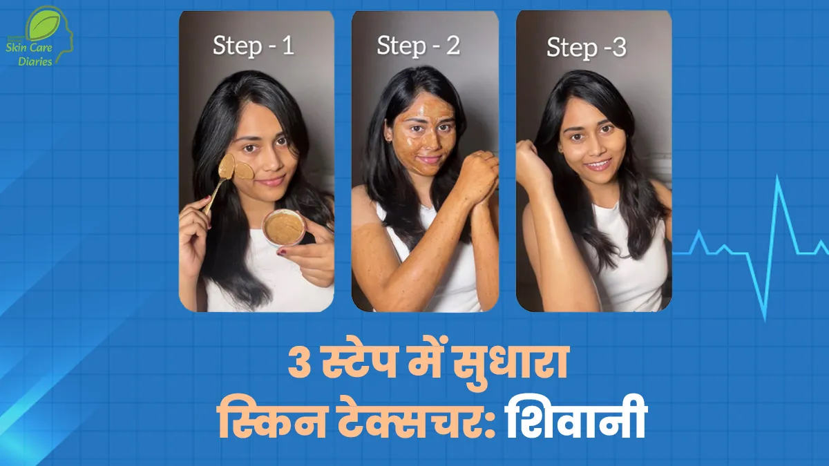 तीन चरण वाले नुस्‍खे से श‍िवानी ने सुधारा स्‍क‍िन टेक्‍सचर, घर बैठे रूखी त्‍वचा को म‍िला न‍िखार
