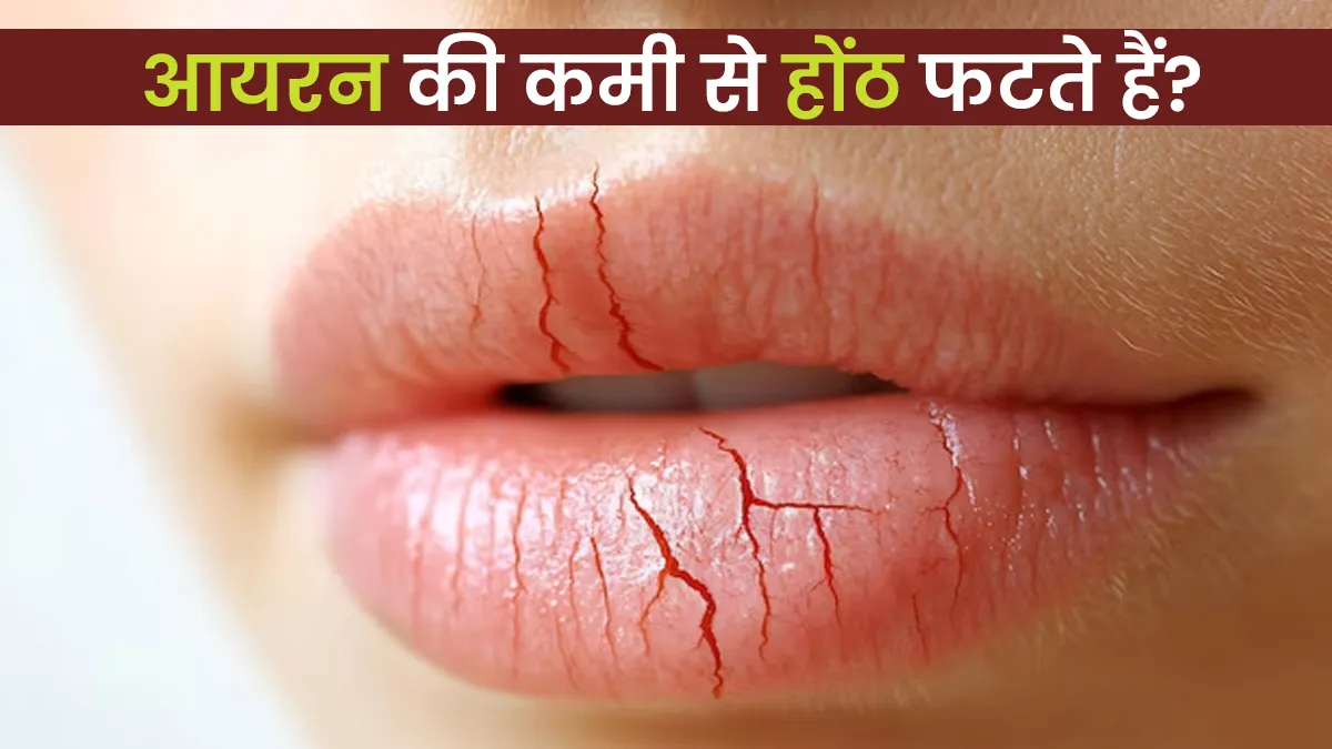 क्या आयरन की कमी से होंठ फटते हैं? एक्सपर्ट से जानें