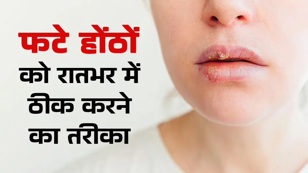 फटे होंठों को रातभर में कैसे ठीक करें? डॉक्टर से जानें