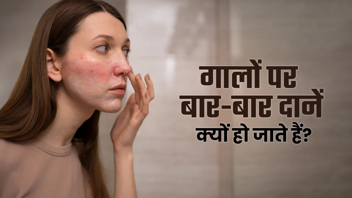 गालों पर बार-बार दानें हो जाते हैं? स्किन केयर से जुड़ी ये 7 गलतियां हो सकती हैं कारण