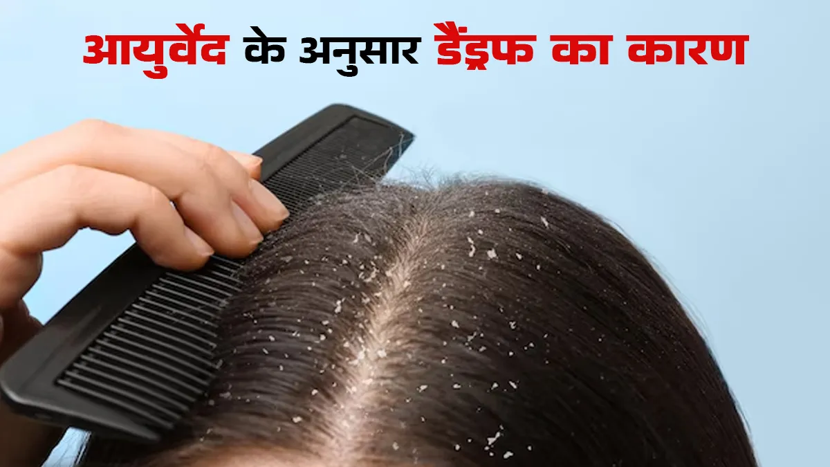 सर्दियों में डैंड्रफ का कारण कहीं कफ दोष तो नहीं? आयुर्वेदाचार्य से जानें कैसे पहचानें और क्या करें