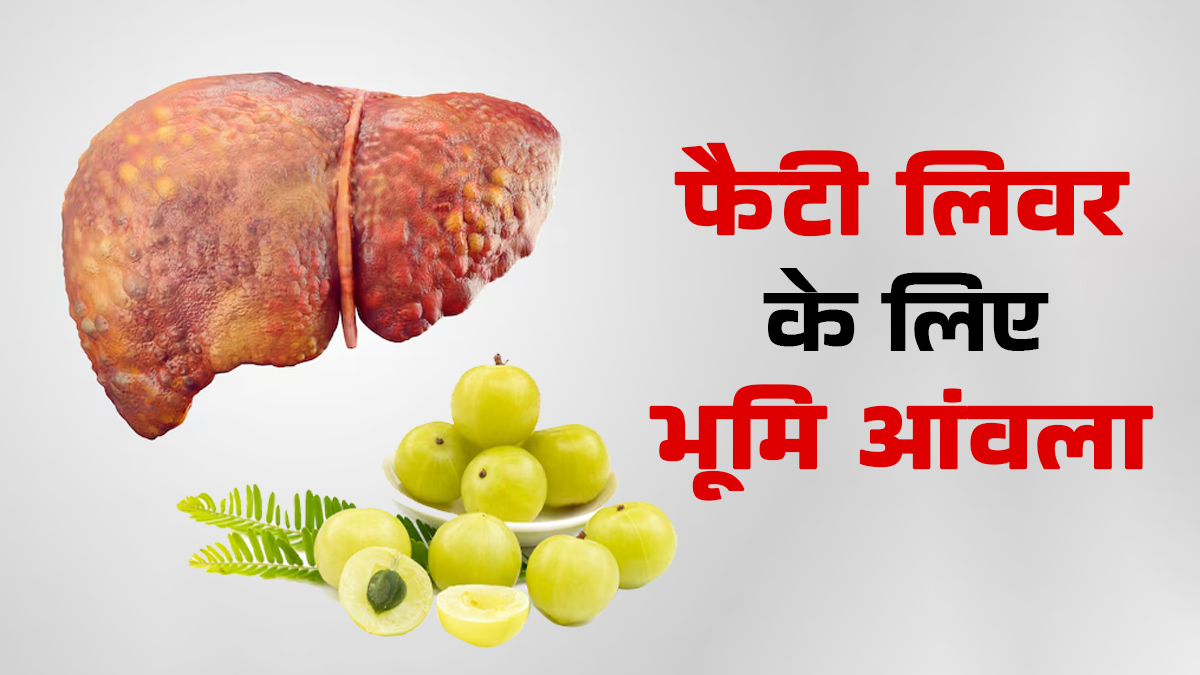 फैटी लिवर के लिए भूमि आंवला का उपयोग कैसे करें? आयुर्वेदिक डॉक्टर से जानें