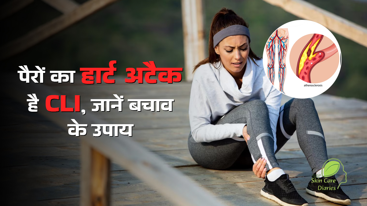 Critical Limb Ischemia: पैरों का 'हार्ट अटैक' क्यों कहा जाता है इस बीमारी को?