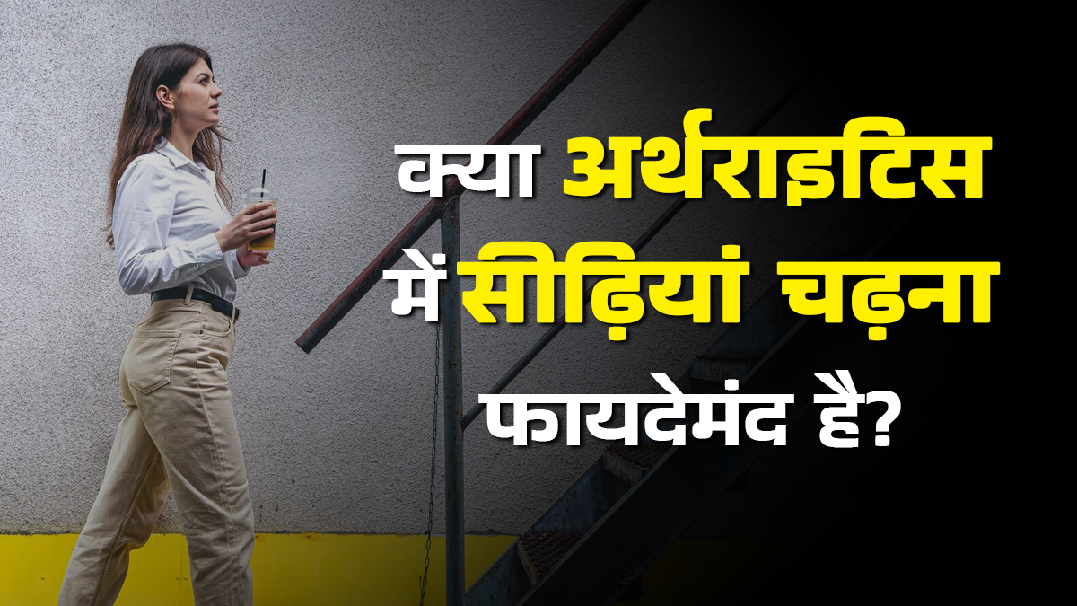 क्या सीढ़ियां चढ़ना अर्थराइटिस के मरीजों के लिए फायदेमंद होता है? जानें डॉक्टर से