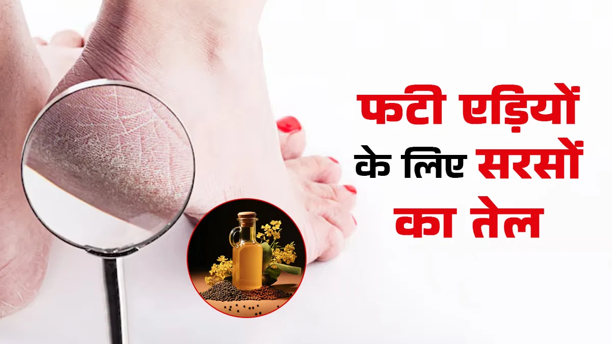सरसों का तेल: फटी एड़ियों का इलाज है एंटीबैक्टरियल गुणों से भरपूर ये तेल, इन 3 तरीकों से करें इस्तेमाल