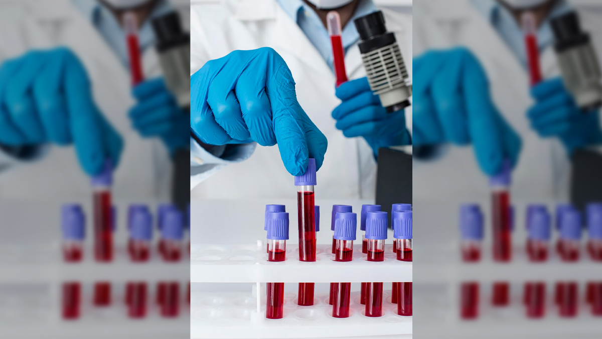 chromium found in blood samples in kanpur ngt seeks action in hindi 1