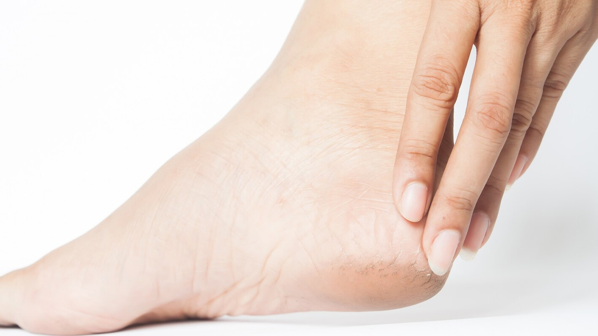 edi-ke-liye-sarso-tel-ke-fayde-minside