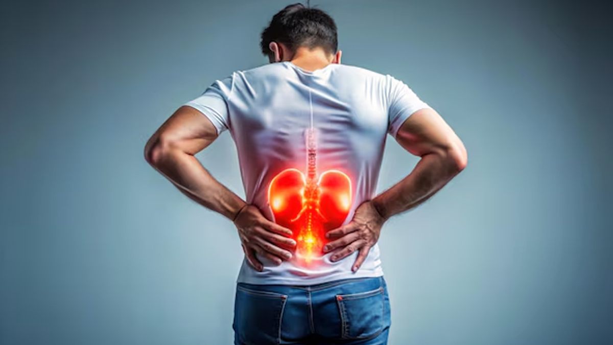 kidney stones 01 (9)