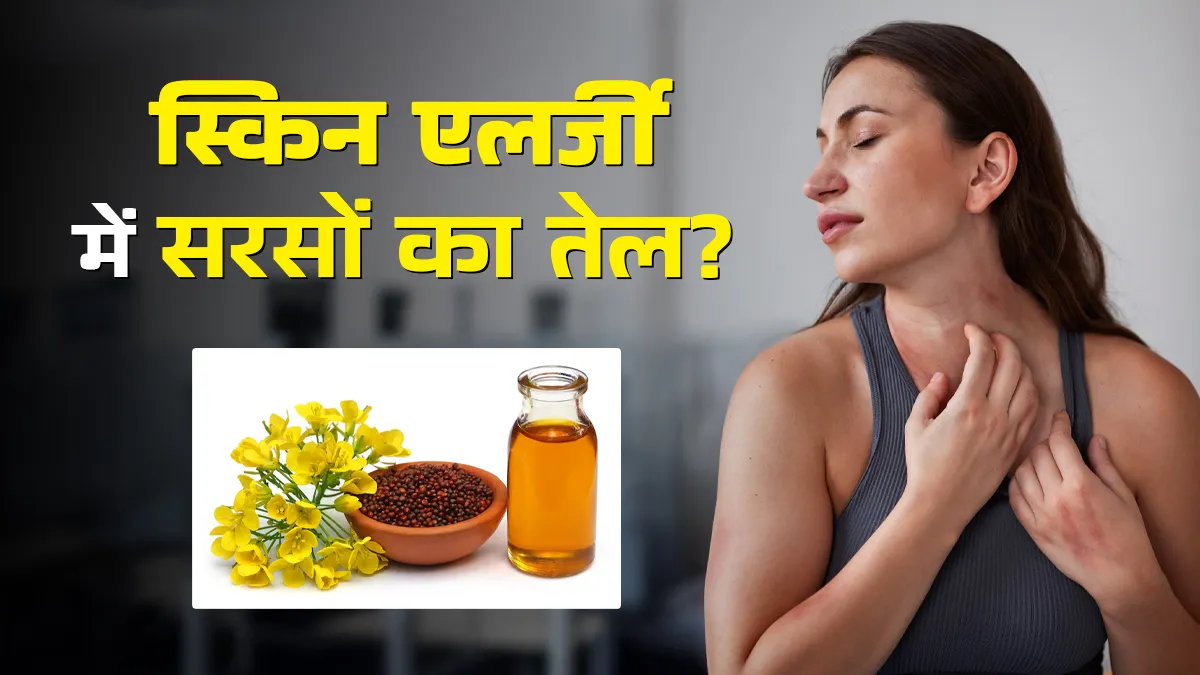 स्किन एलर्जी में सरसों का तेल लगाते हैं? डर्मेटोलॉजिस्ट से जानें क्या है सही