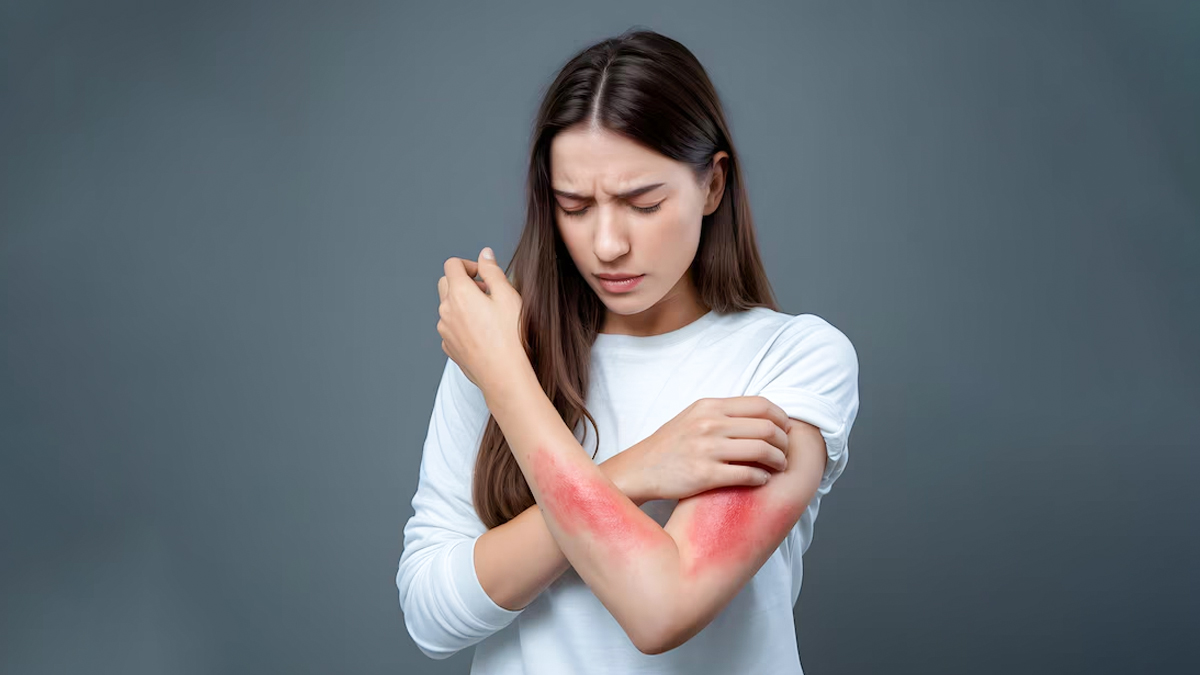 is mustard oil good for skin allergies