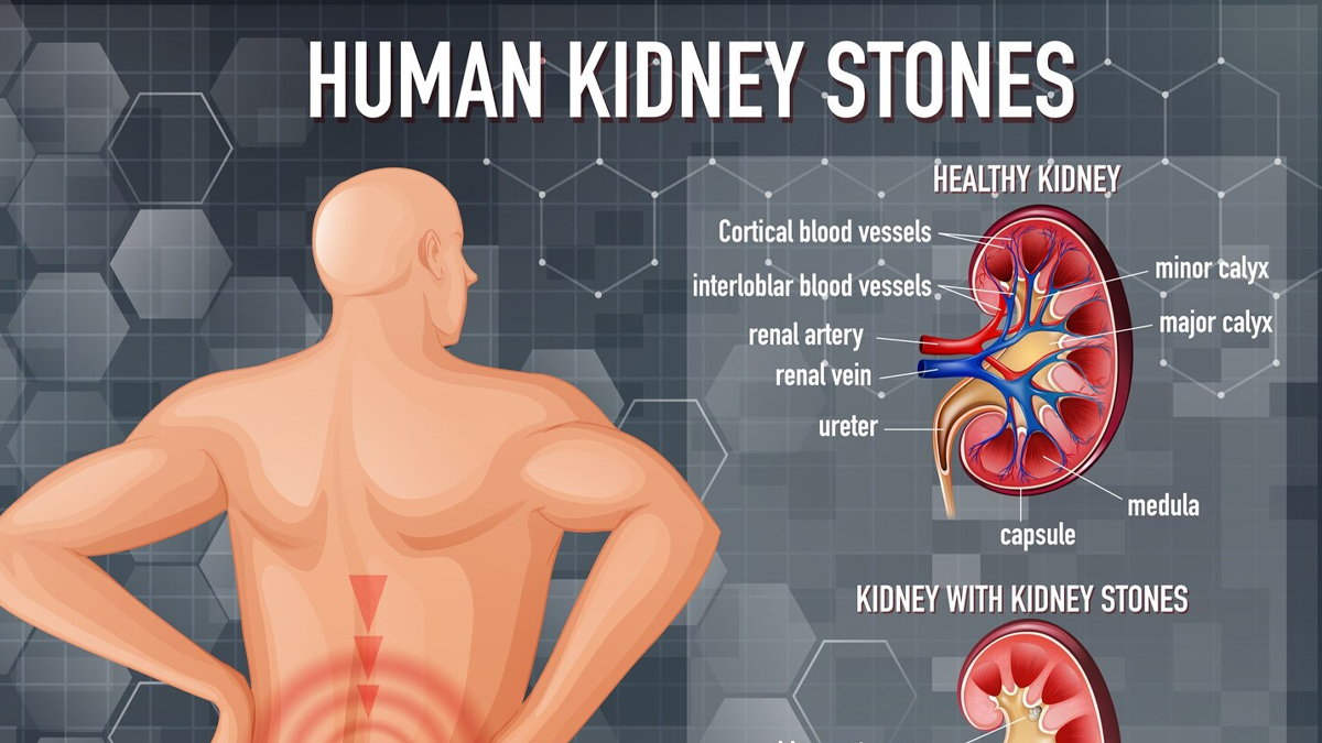 kya-palak-khane-se-pathri-hoti-hai