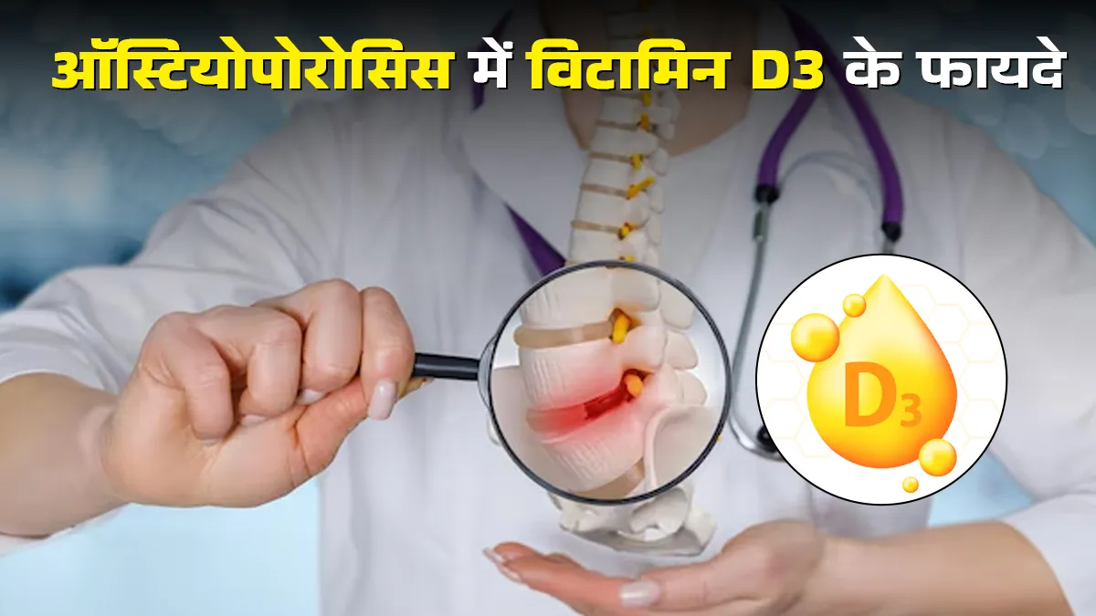 Vitamin D3: चटकती हड्डियों का सहारा है ये विटामिन, जानें ऑस्टियोपोरोसिस के मरीजों के लिए क्यों है जरूरी