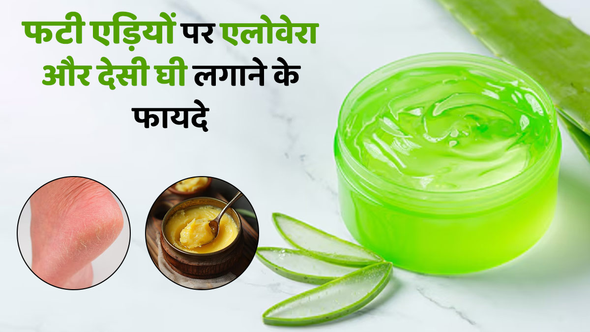 फटी एड़ियों के कारण चलने में हो रही है दिक्कत, एलोवेरा और देसी घी से मिलेगा आराम