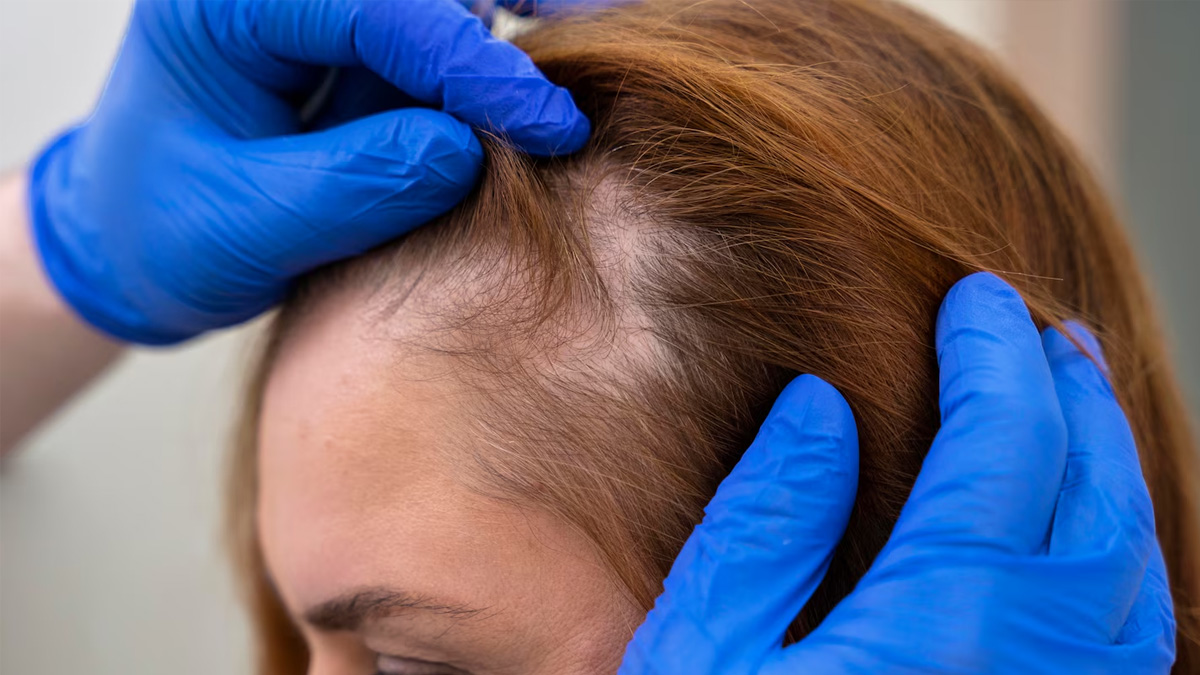 can dead hair follicles be revived 1 (7)