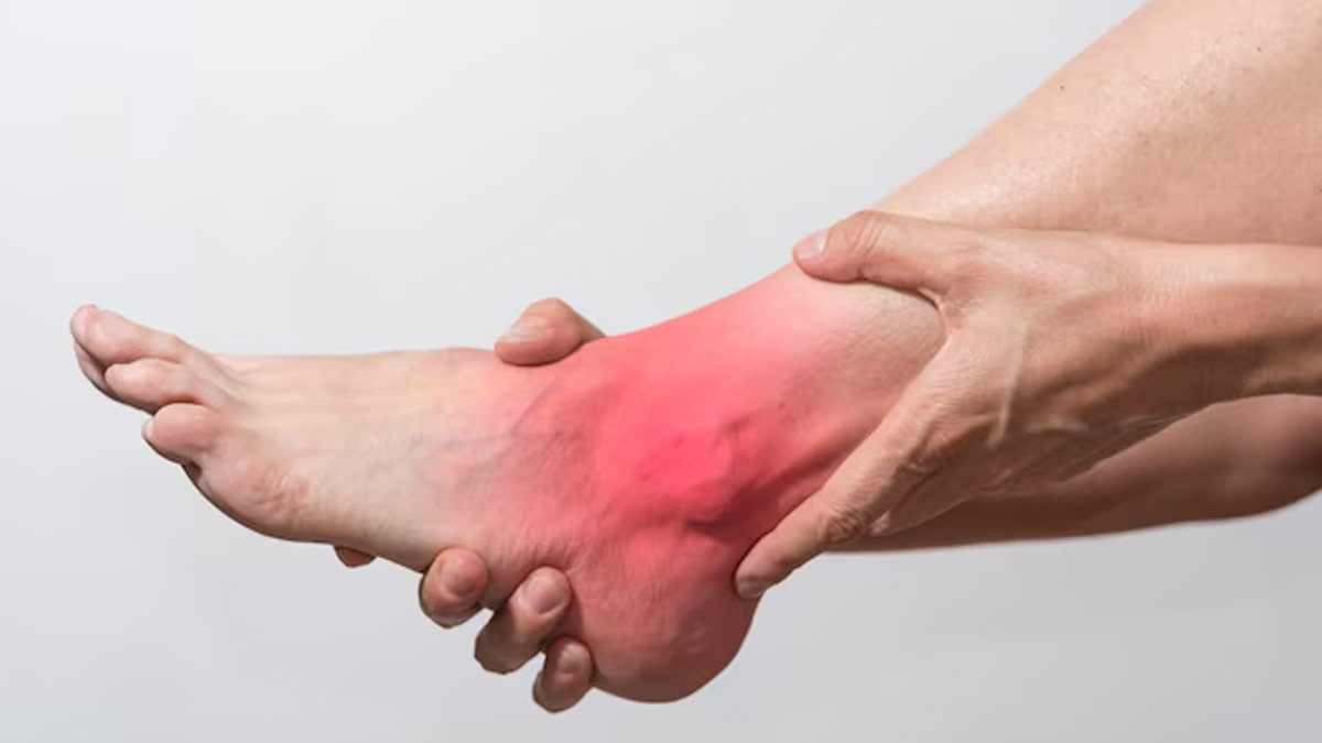 does stress increase uric acid in hindi 1