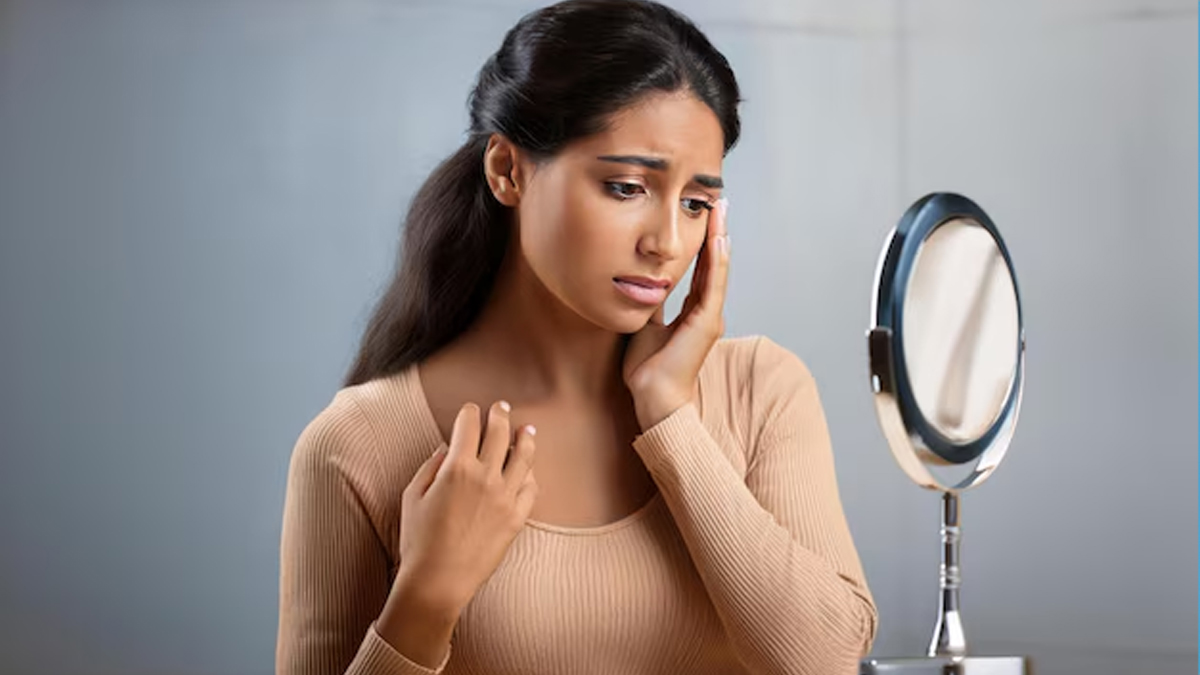 How winter weather impacts your skin 01 (10)