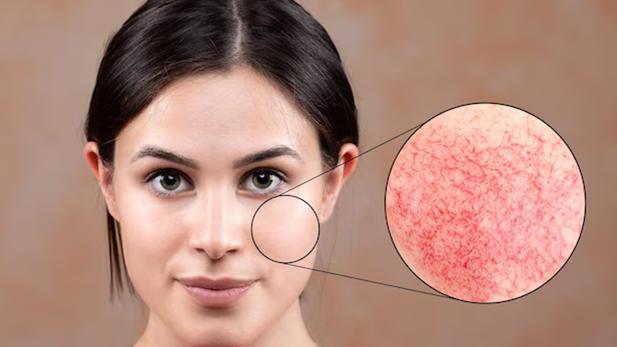 dry skin ghee and besan  1 (8)