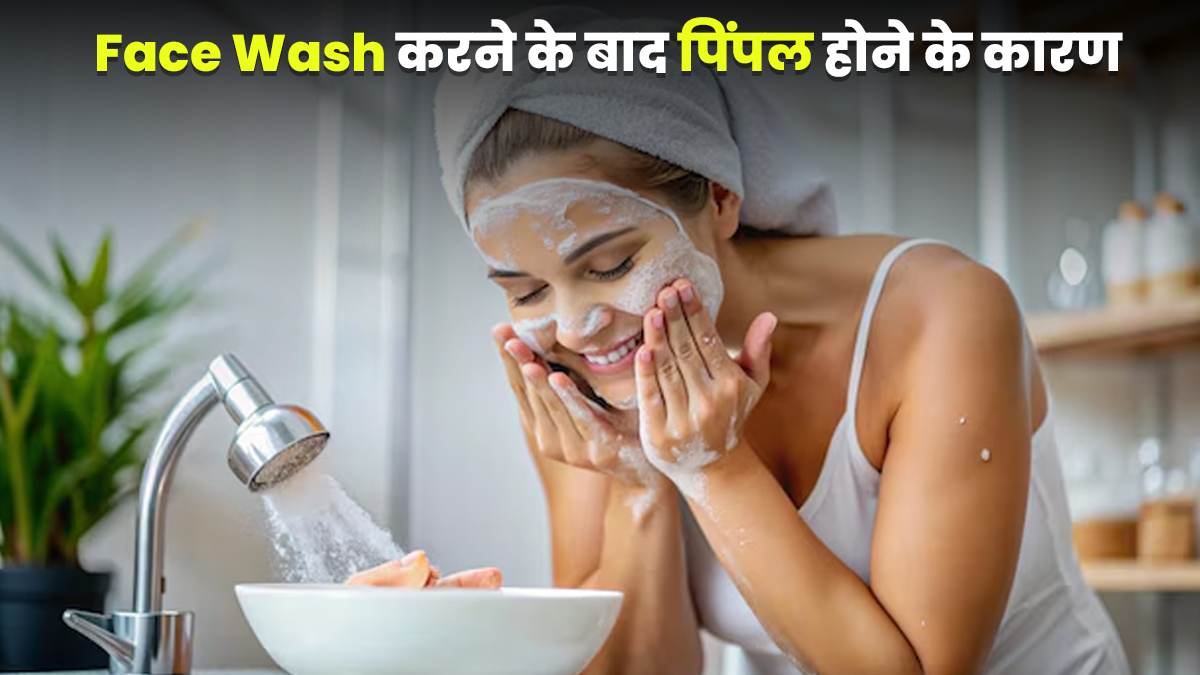 फेस वॉश करने के बाद हो जाते हैं पिंपल? डॉक्टर से जानें ऐसा होने के कारण