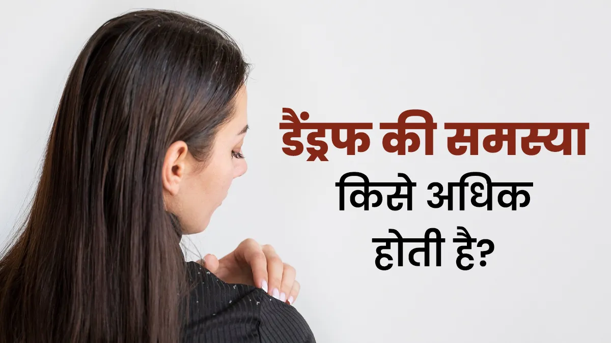 डैंड्रफ की समस्या: इन 4 तरह के लोगों को रहता है इसका रिस्क ज्यादा, जानें बचाव के टिप्स