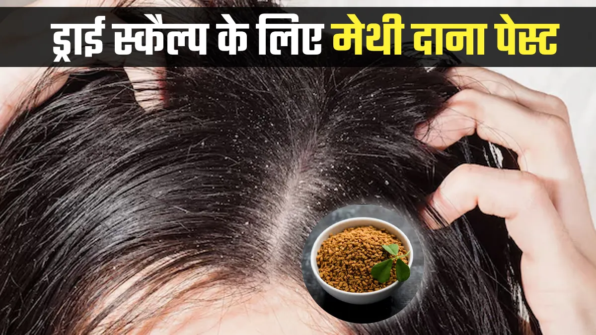 ड्राई स्कैल्प से राहत के लिए करें मेथी दाना पेस्ट का इस्तेमाल, मिलेंगे कई लाभ