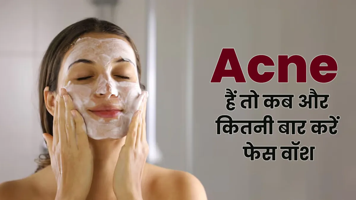 क्या आपके चेहरे पर भी हैं Acne? जानें कब और कितनी बार करें फेस वॉश